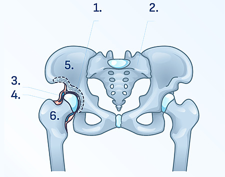 Hip joint