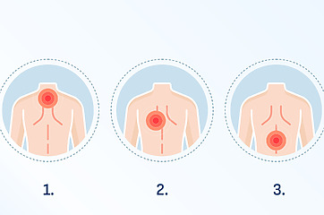 Back pain map - shows where the pain may occur